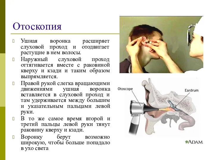 Отоскопия Ушная воронка расширяет слуховой проход и отодвигает растущие в