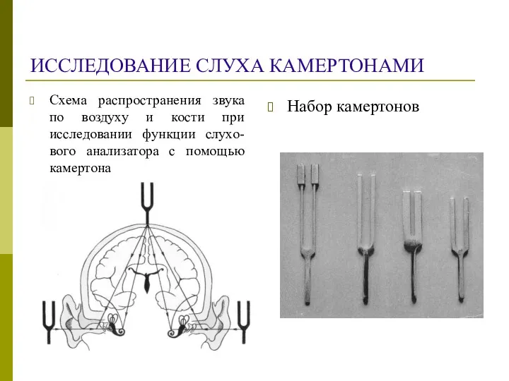 ИССЛЕДОВАНИЕ СЛУХА КАМЕРТОНАМИ Схема распространения звука по воздуху и кости