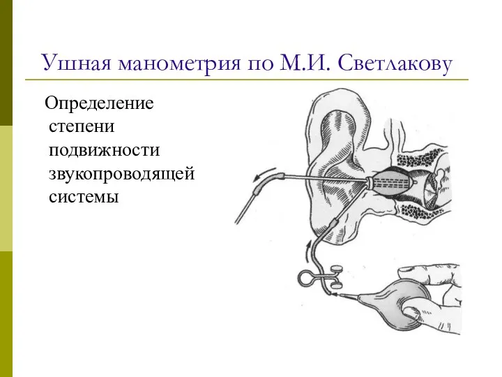 Ушная манометрия по М.И. Светлакову Определение степени подвижности звукопроводящей системы