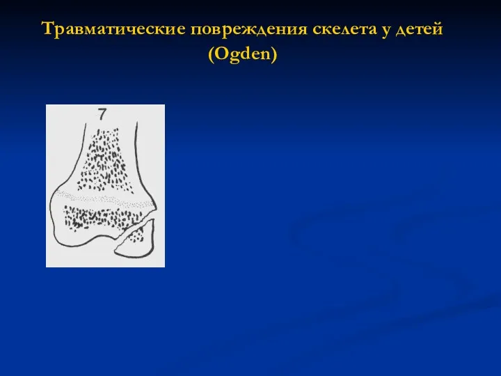 Травматические повреждения скелета у детей (Ogden)