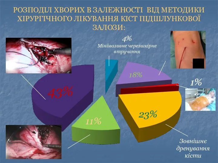 РОЗПОДІЛ ХВОРИХ В ЗАЛЕЖНОСТІ ВІД МЕТОДИКИ ХІРУРГІЧНОГО ЛІКУВАННЯ КІСТ ПІДШЛУНКОВОЇ