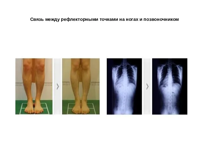 Связь между рефлекторными точками на ногах и позвоночником