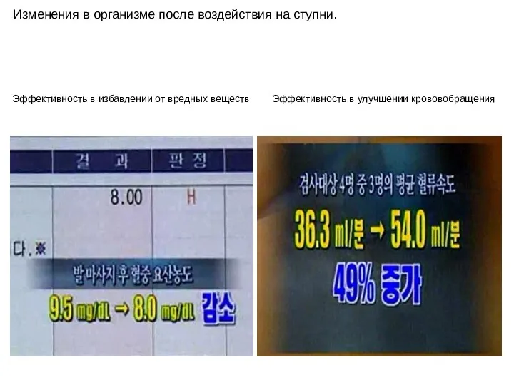 Изменения в организме после воздействия на ступни. Эффективность в избавлении