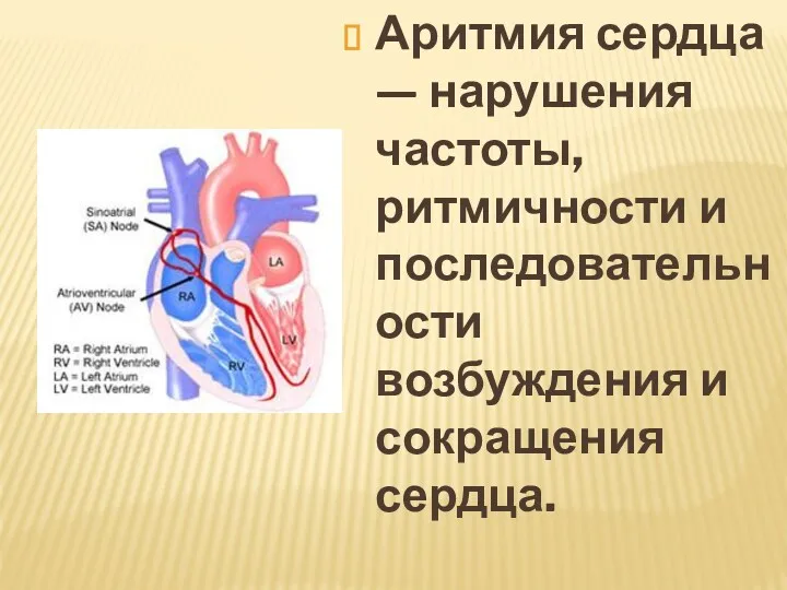 Аритмия сердца — нарушения частоты, ритмичности и последовательности возбуждения и сокращения сердца.