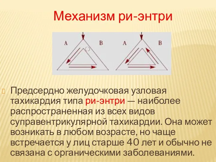 Предсердно желудочковая узловая тахикардия типа ри-энтри — наиболее распространенная из