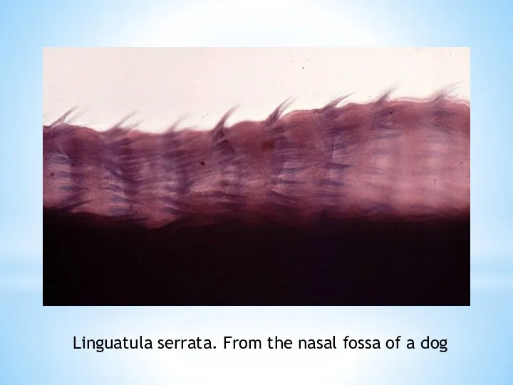 Linguatula serrata. From the nasal fossa of a dog