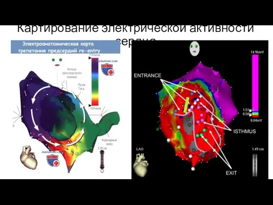 Картирование электрической активности сердца