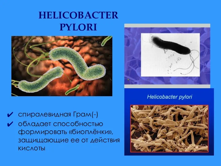 HELICOBACTER PYLORI спиралевидная Грам(-) обладает способностью формировать «биоплёнки», защищающие ее от действия кислоты