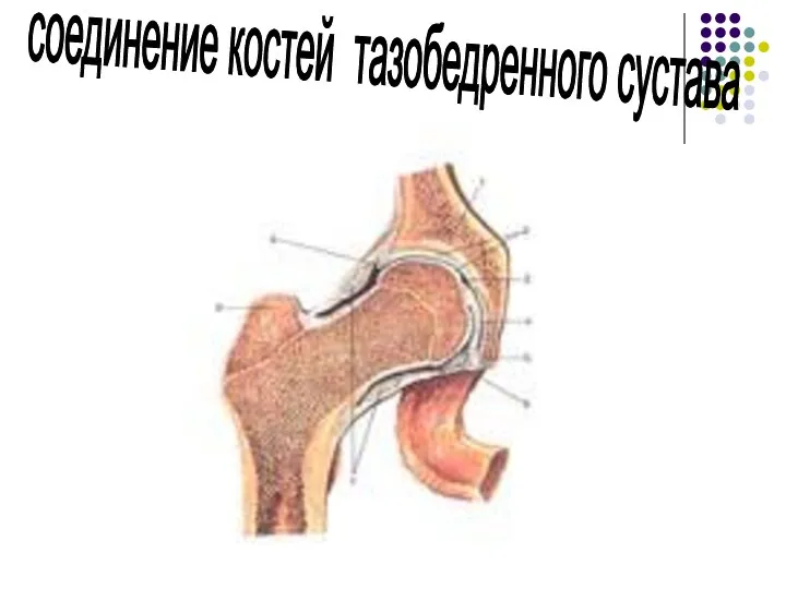 соединение костей тазобедренного сустава