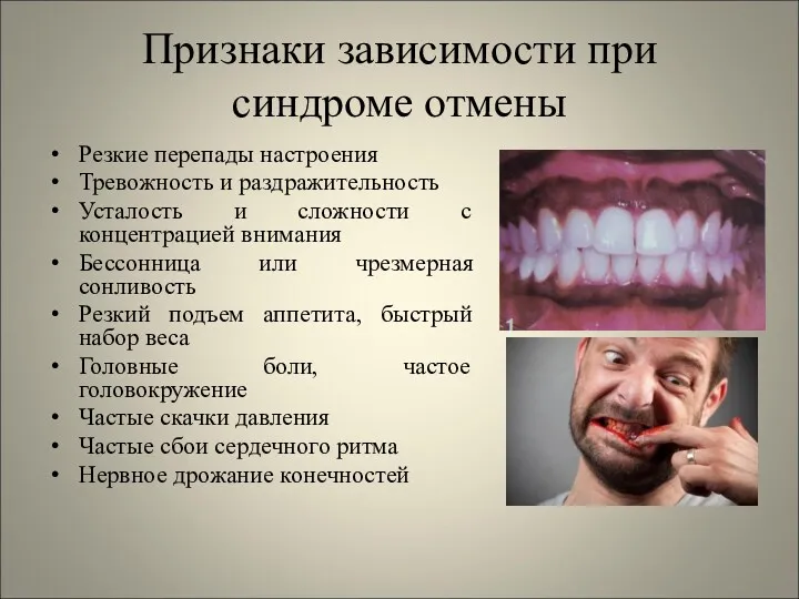 Признаки зависимости при синдроме отмены Резкие перепады настроения Тревожность и