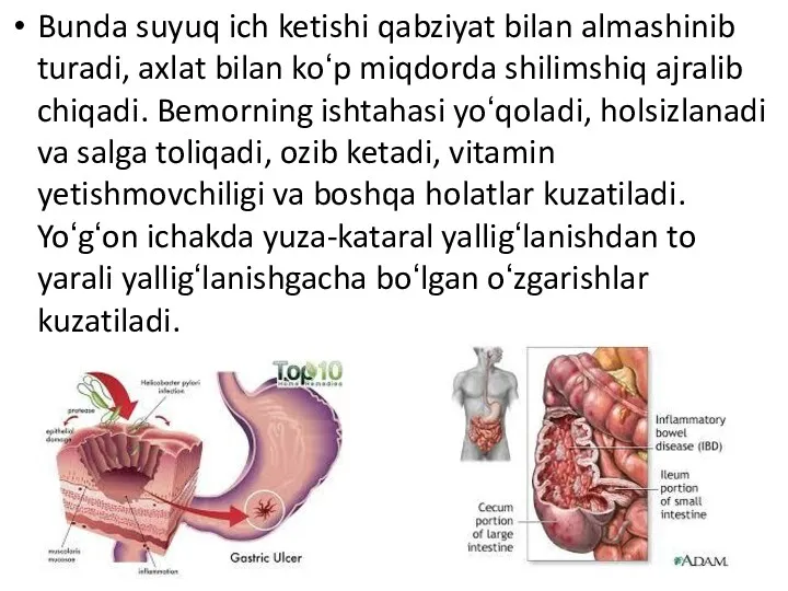 Bunda suyuq ich ketishi qabziyat bilan almashinib turadi, axlat bilan