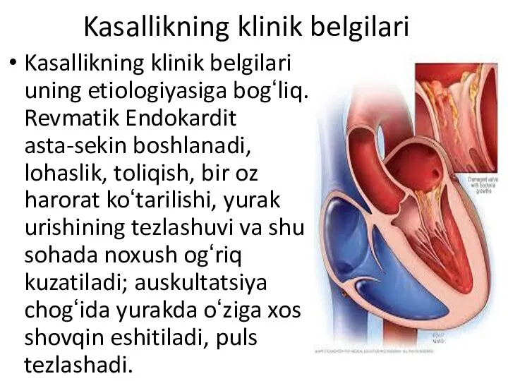 Kasallikning klinik belgilari Kasallikning klinik belgilari uning etiologiyasiga bogʻliq. Revmatik