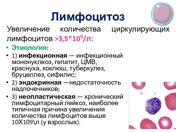 Лимфоцитоз Этиология: 1) инфекционная — инфекционный мононуклеоз, гепатит, ЦМВ, краснуха, коклюш, туберкулез, бруцеллез,