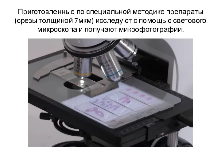 Приготовленные по специальной методике препараты (срезы толщиной 7мкм) исследуют с помощью светового микроскопа и получают микрофотографии.