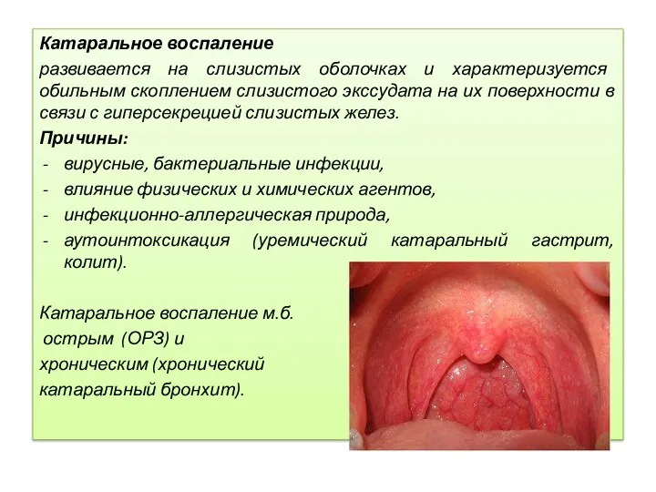 Катаральное воспаление развивается на слизистых оболочках и характеризуется обильным скоплением