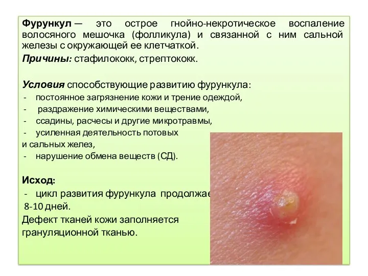 Фурункул — это острое гнойно-некротическое воспаление волосяного мешочка (фолликула) и