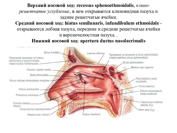 Верхний носовой ход: recessus sphenoethmoidalis, клино-решетчатое углубление, в нем открывается клиновидная пазуха и
