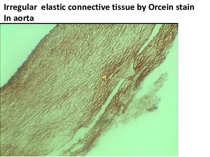 Irregular elastic connective tissue by Orcein stain In aorta