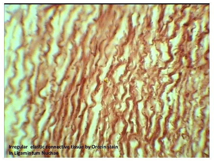 Irregular elastic connective tissue by Orcein stain In Ligamintum Nuchae