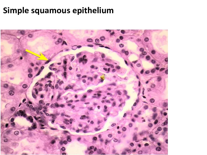 Simple squamous epithelium