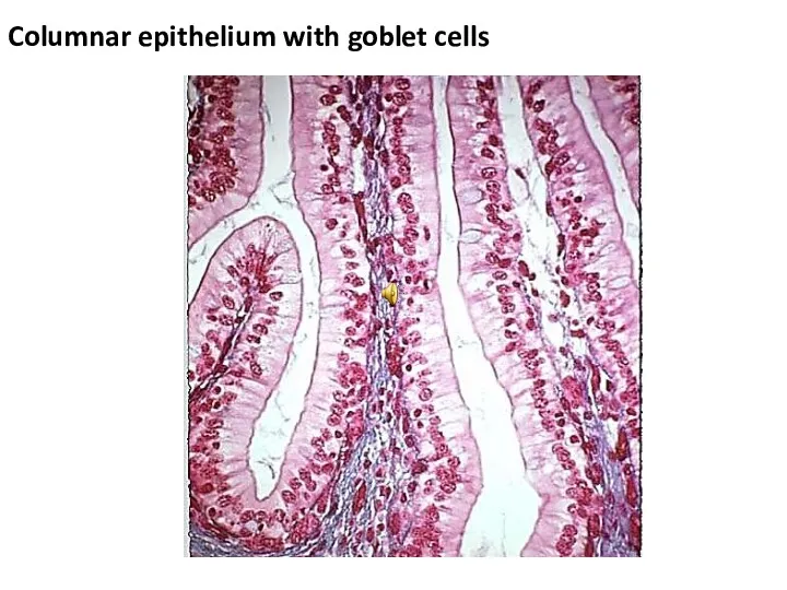 Columnar epithelium with goblet cells