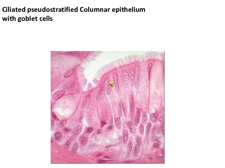 Ciliated pseudostratified Columnar epithelium with goblet cells