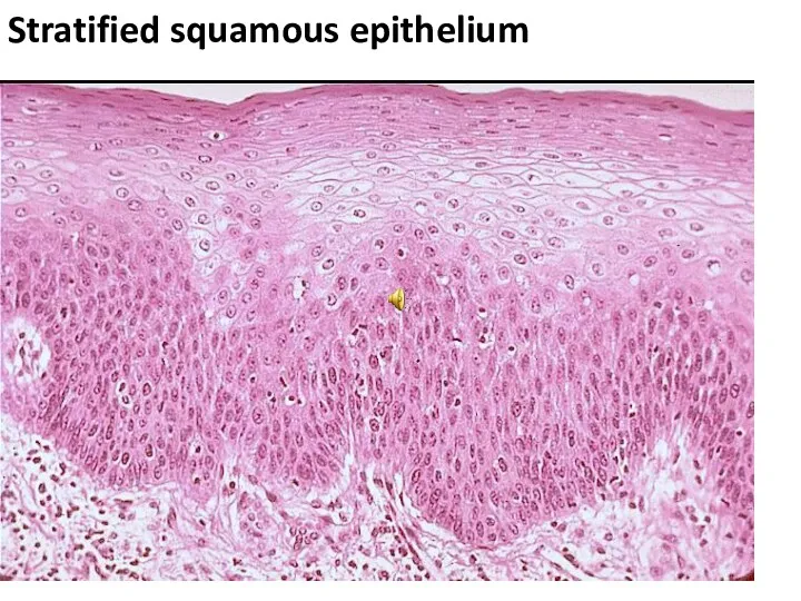 Stratified squamous epithelium