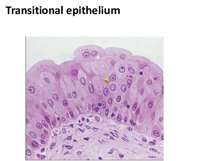 Transitional epithelium