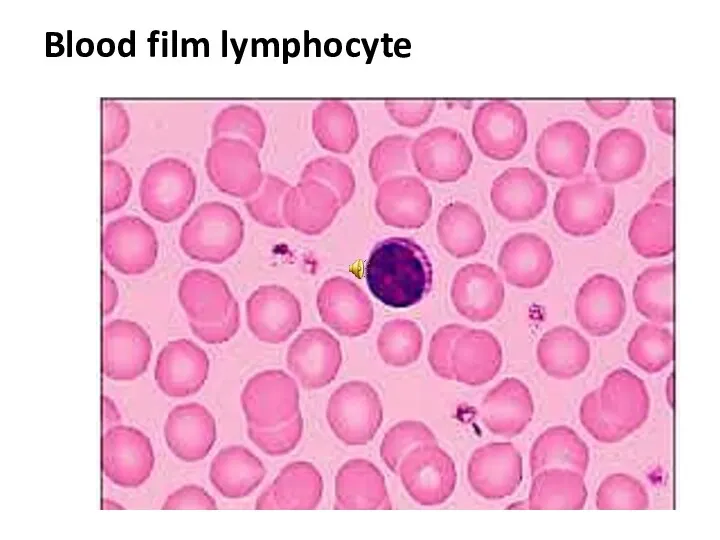 Blood film lymphocyte