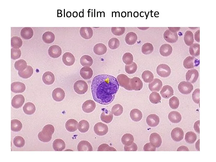 Blood film monocyte