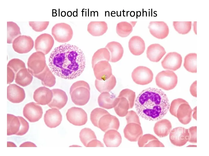 Blood film neutrophils