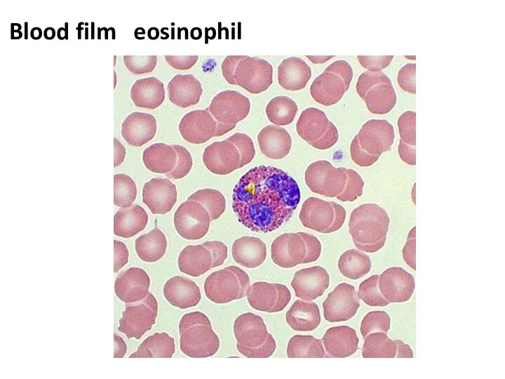 Blood film eosinophil