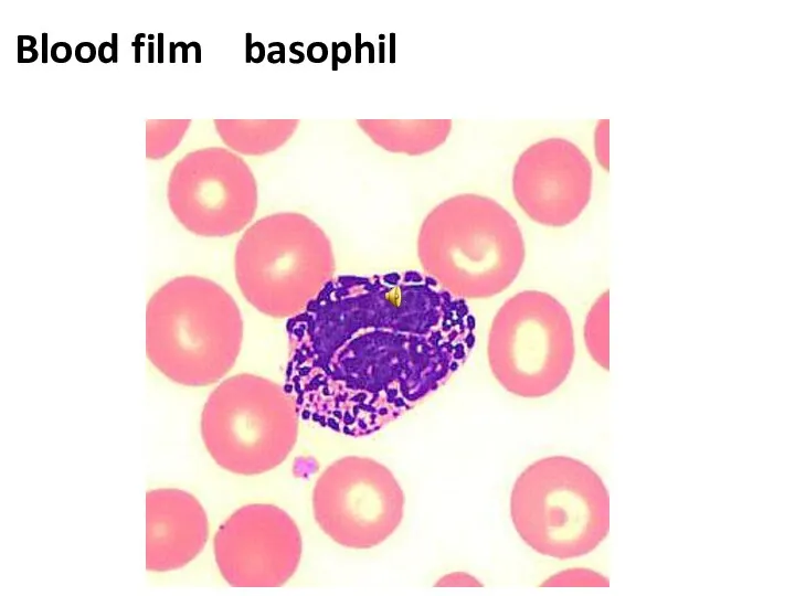 Blood film basophil