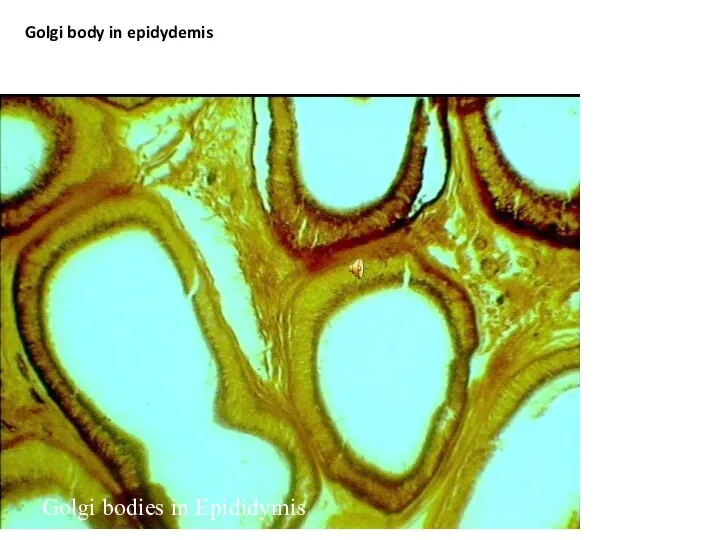 Golgi bodies in Epididymis Golgi body in epidydemis