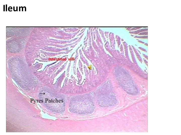 → Pyres Patches Ileum Intestinal villi