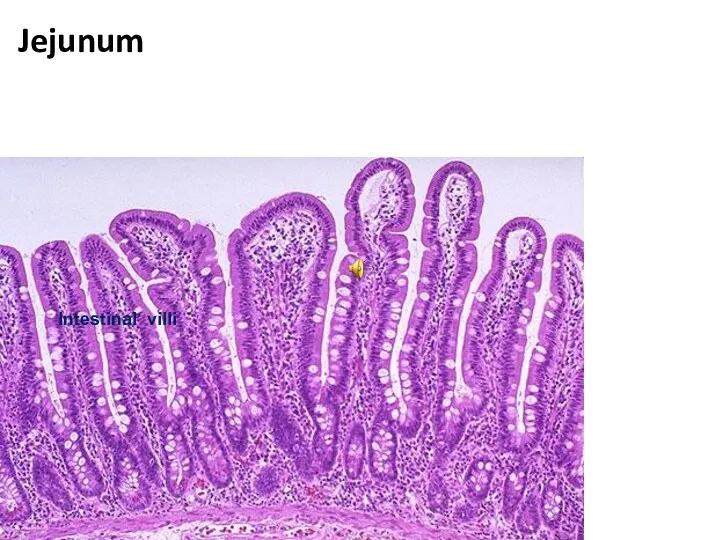 Jejunum Intestinal villi