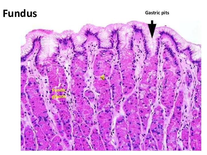 Fundus Gastric pits Fundic glands