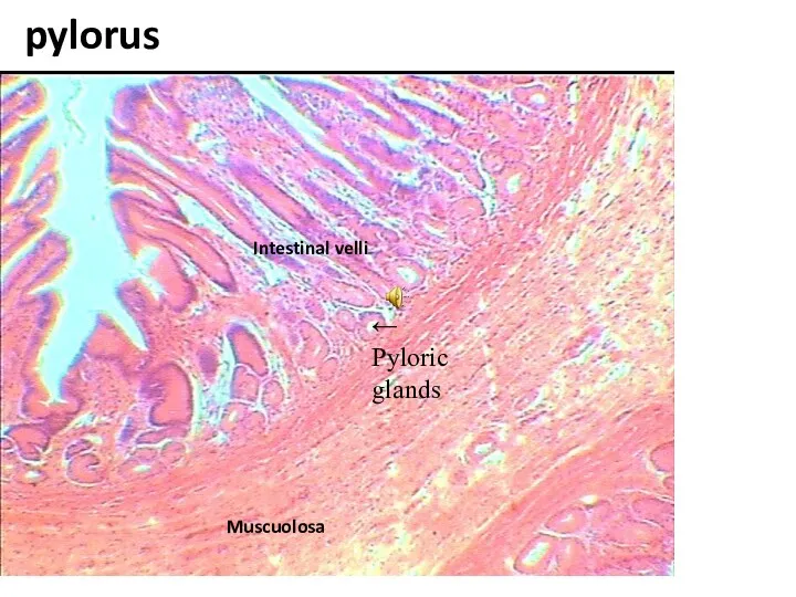← Pyloric glands pylorus Intestinal velli Muscuolosa