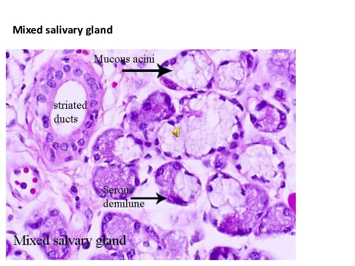 Mixed salivary gland