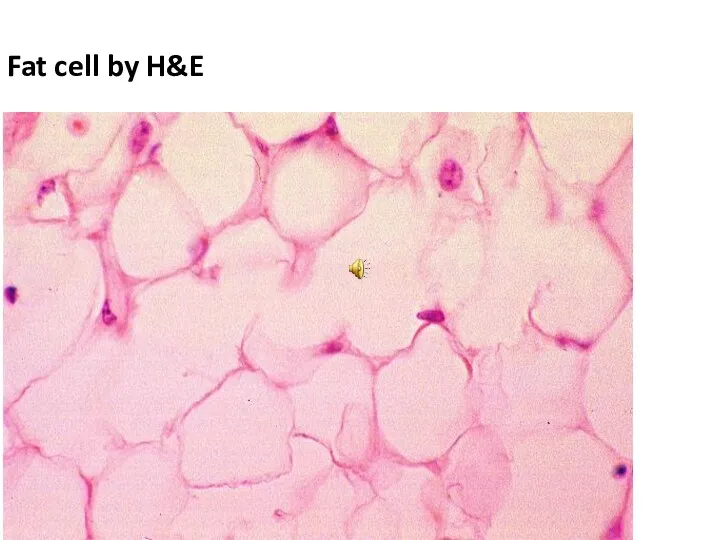 Fat cell by H&E