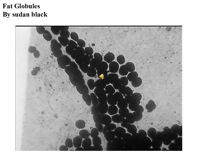 Fat Globules By sudan black