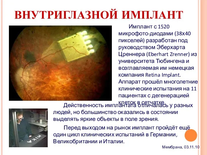 ВНУТРИГЛАЗНОЙ ИМПЛАНТ Имплант с 1520 микрофото-диодами (38х40 пикселей) разработан под руководством Эберхарта Цреннера