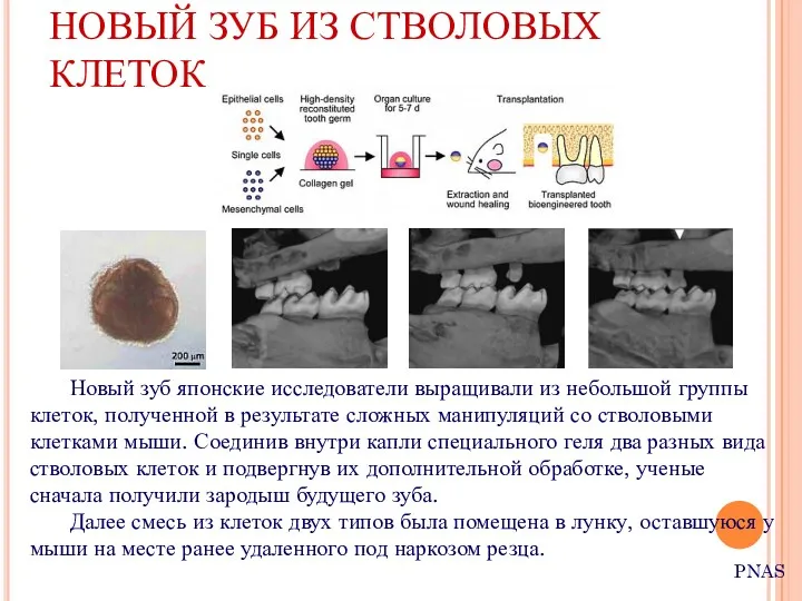 НОВЫЙ ЗУБ ИЗ СТВОЛОВЫХ КЛЕТОК Новый зуб японские исследователи выращивали из небольшой группы