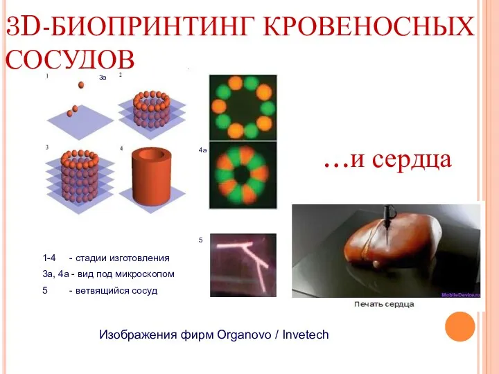 3D-БИОПРИНТИНГ КРОВЕНОСНЫХ СОСУДОВ 3a 4a 5 1-4 - стадии изготовления 3а, 4а -