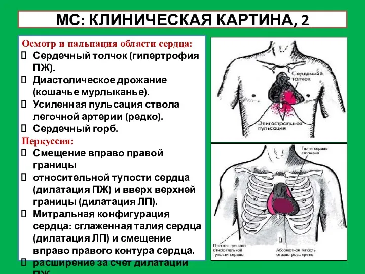 МС: КЛИНИЧЕСКАЯ КАРТИНА, 2 Осмотр и пальпация области сердца: Сердечный