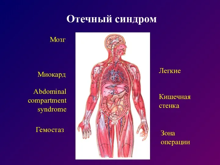 Отечный синдром Мозг Легкие Миокард Кишечная стенка Abdominal compartment syndrome Зона операции Гемостаз