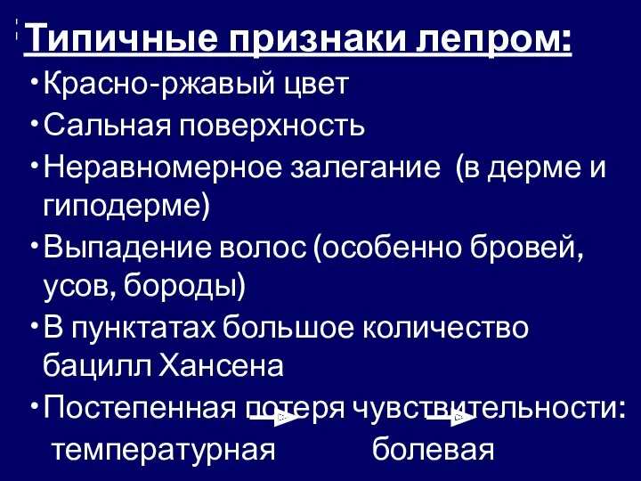 Типичные признаки лепром: Красно-ржавый цвет Сальная поверхность Неравномерное залегание (в