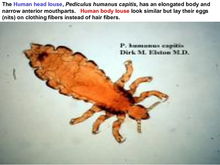 The Human head louse, Pediculus humanus capitis, has an elongated body and narrow