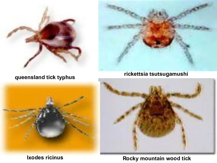queensland tick typhus rickettsia tsutsugamushi Ixodes ricinus Rocky mountain wood tick