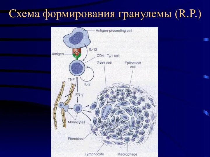 Схема формирования гранулемы (R.P.)